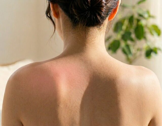 もっこり肩の正体は「せり上がった肩甲骨」？根本から解消する肩甲骨リセット術